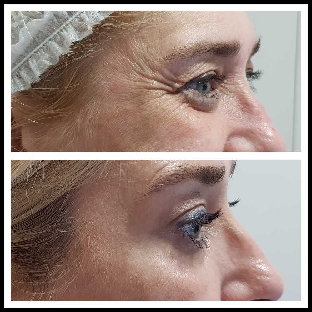 Rosalba Herrero Zerpa-381