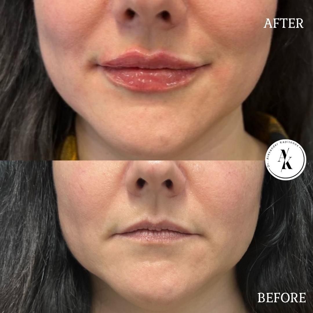 Alexandr Kapitonov-8