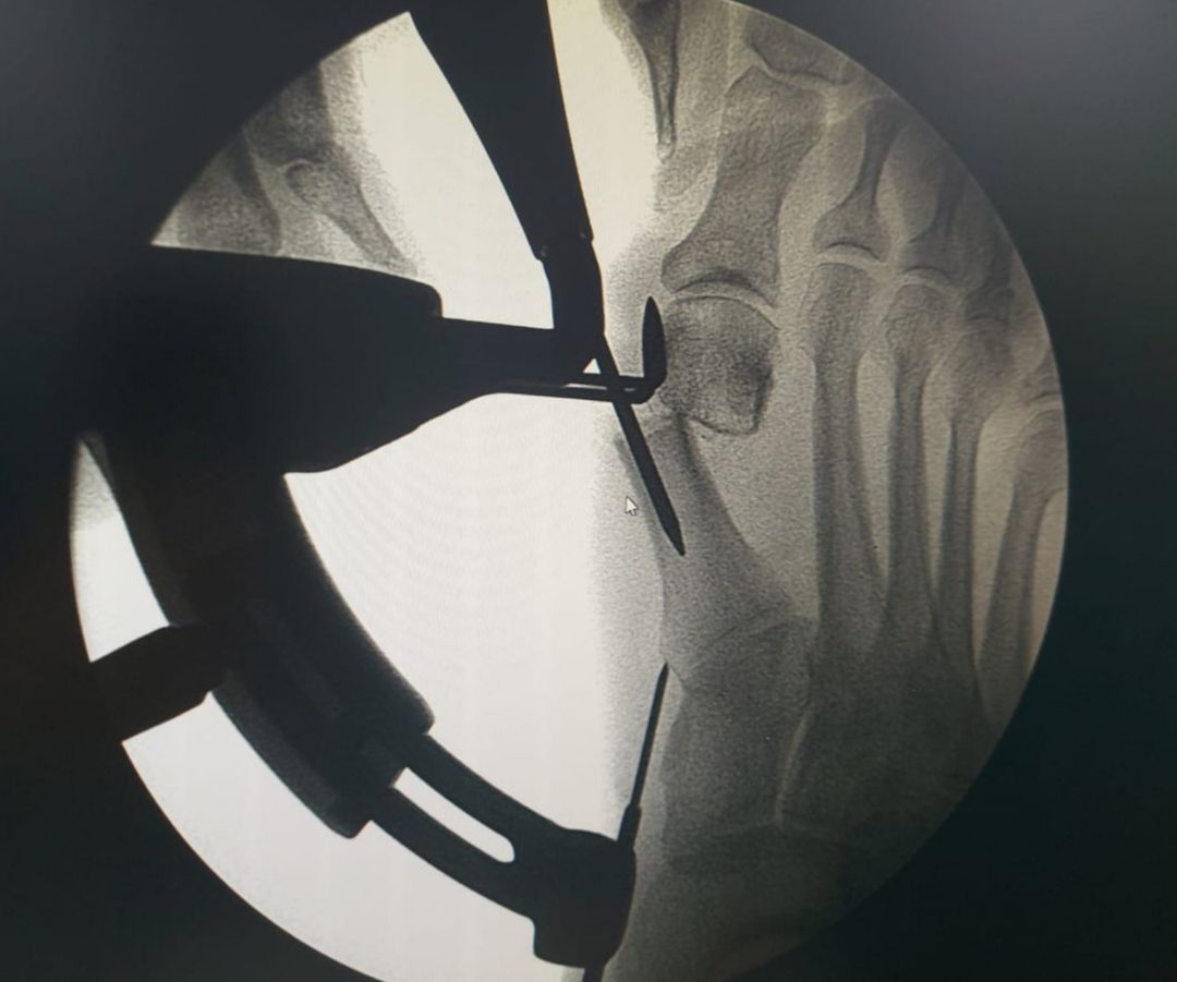 Riccardo Chiavegatti-10