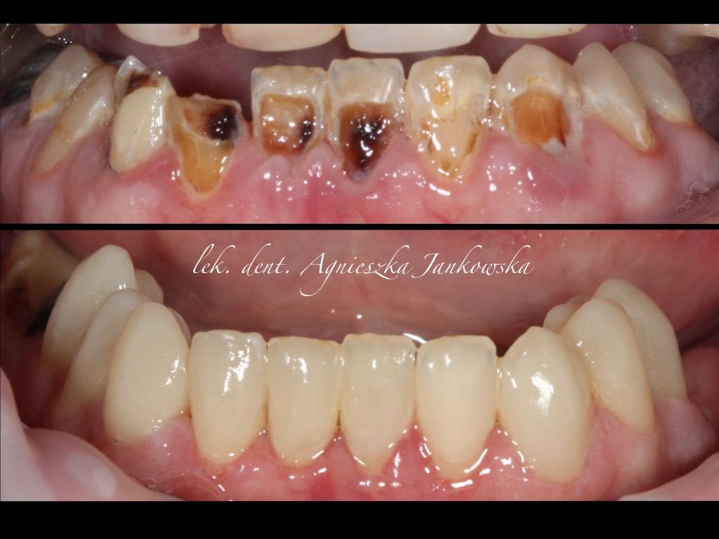 Agnieszka Jankowska-Smolińska-5