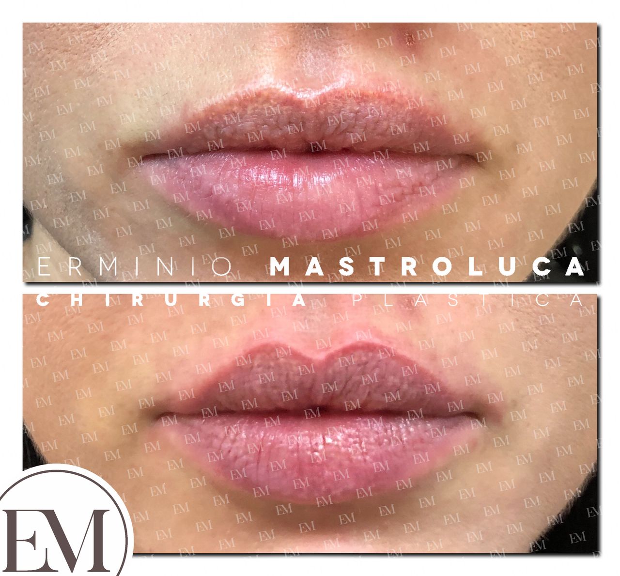 Erminio Mastroluca-0