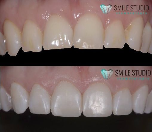 Michał Jankowski-25