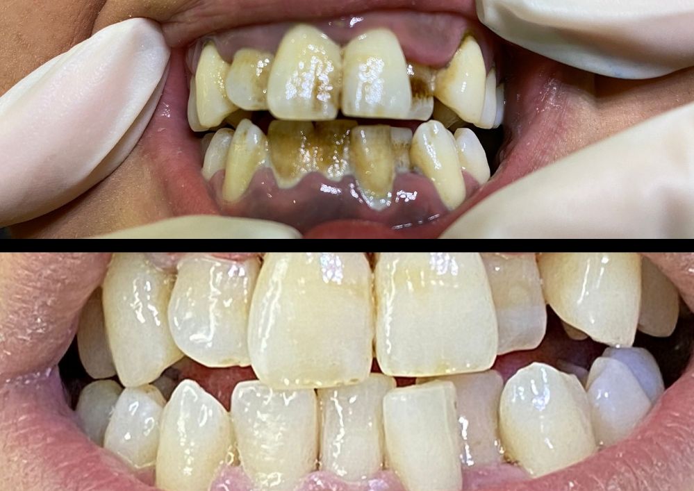 Alessandro Cassese-14