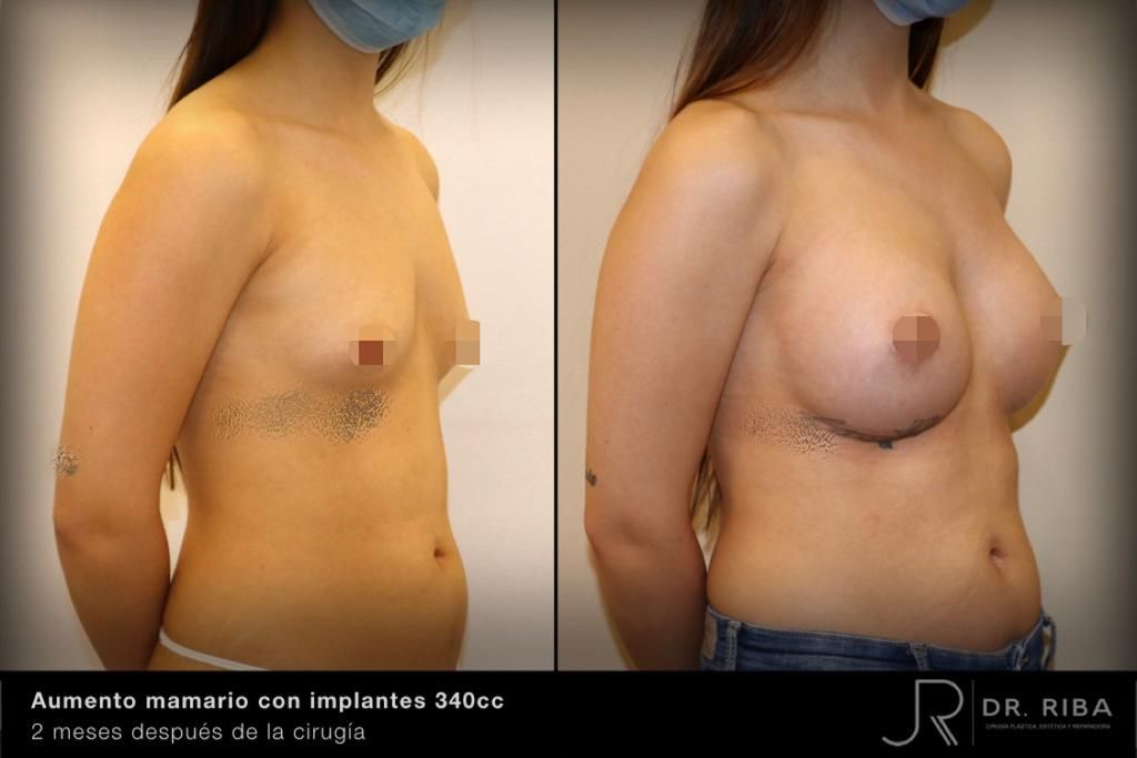 Jordi Riba Vilchez-10