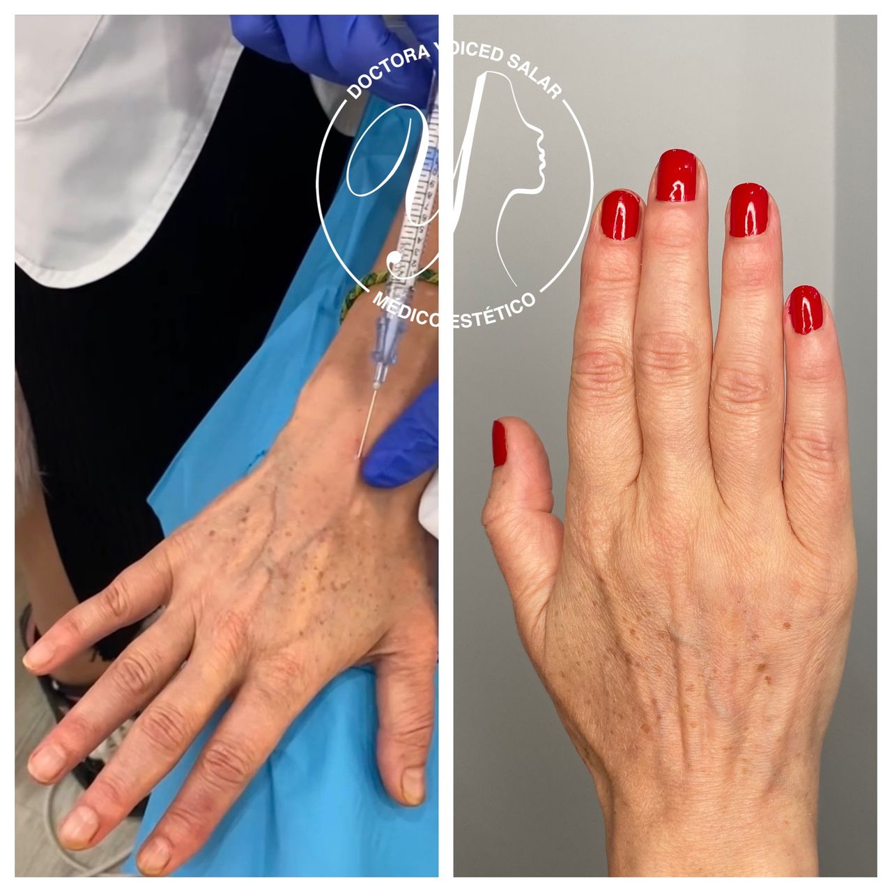 Yoiced Salar Peñate-10