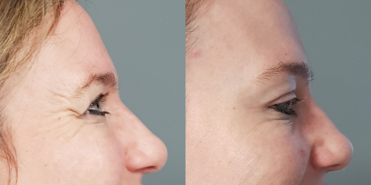 Rosalba Herrero Zerpa-489