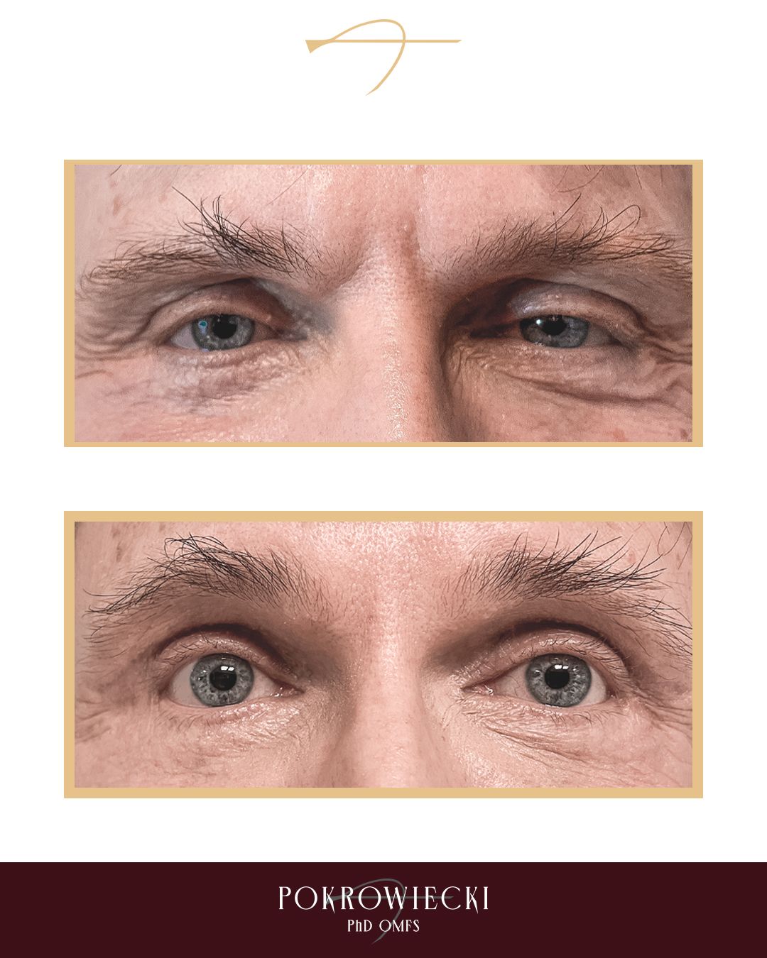 Rafał Pokrowiecki-34