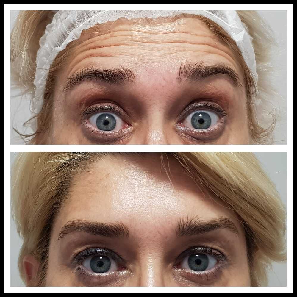 Rosalba Herrero Zerpa-379