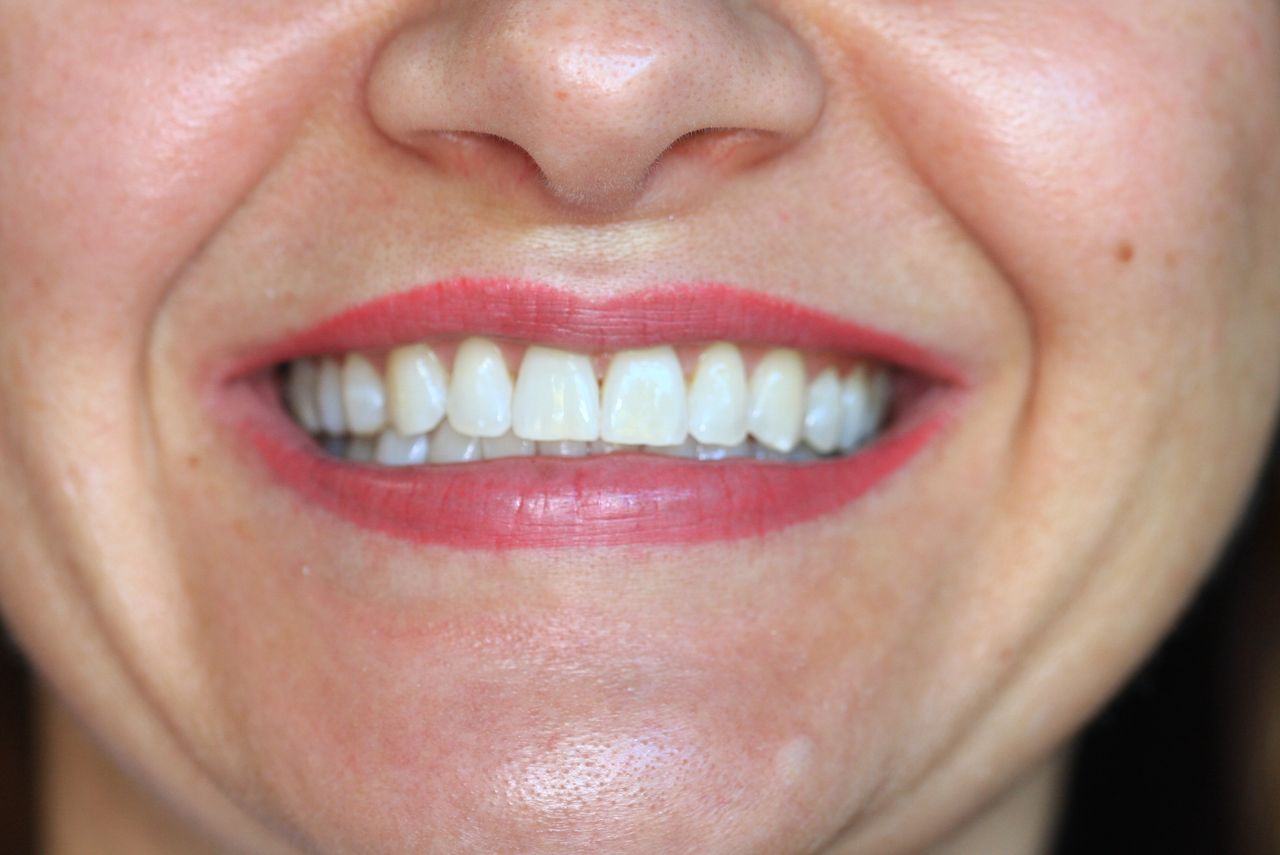 Paulina Sawicka-Soszyńska-15