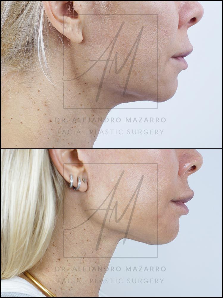 Alejandro Mazarro Campos-9