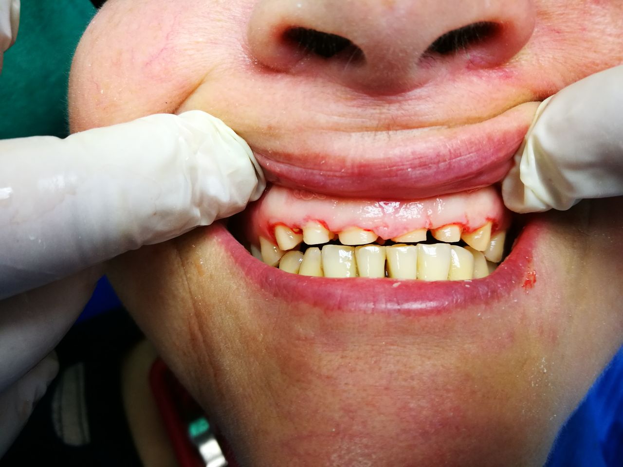 Stefano De Simone-23