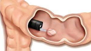 Jose Francisco Juanmartiñena-9