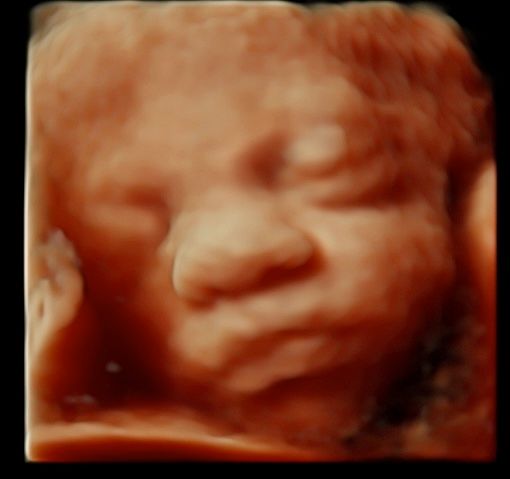 Tommaso Incandela-51