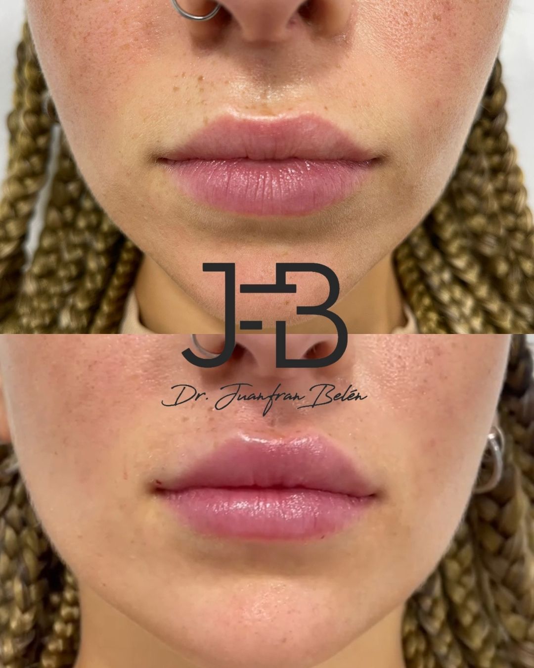 Juan Francisco Belén Montero-17