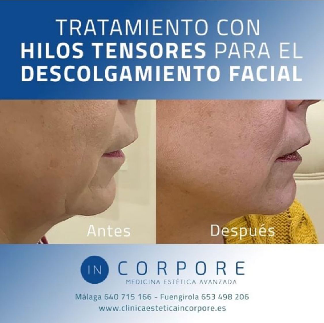 Juan Enrique Pérez Enríquez-33