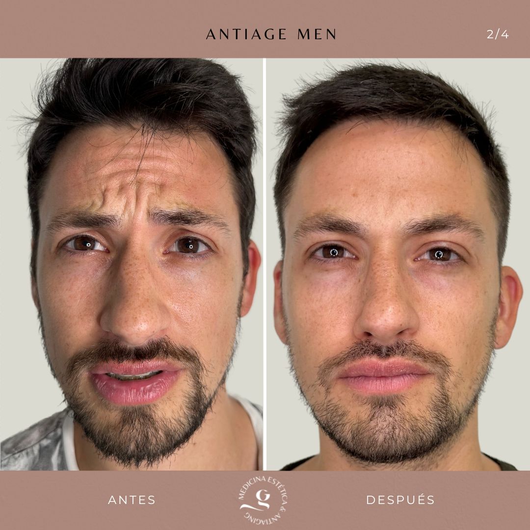 ​Giovanni Giorgianni-7