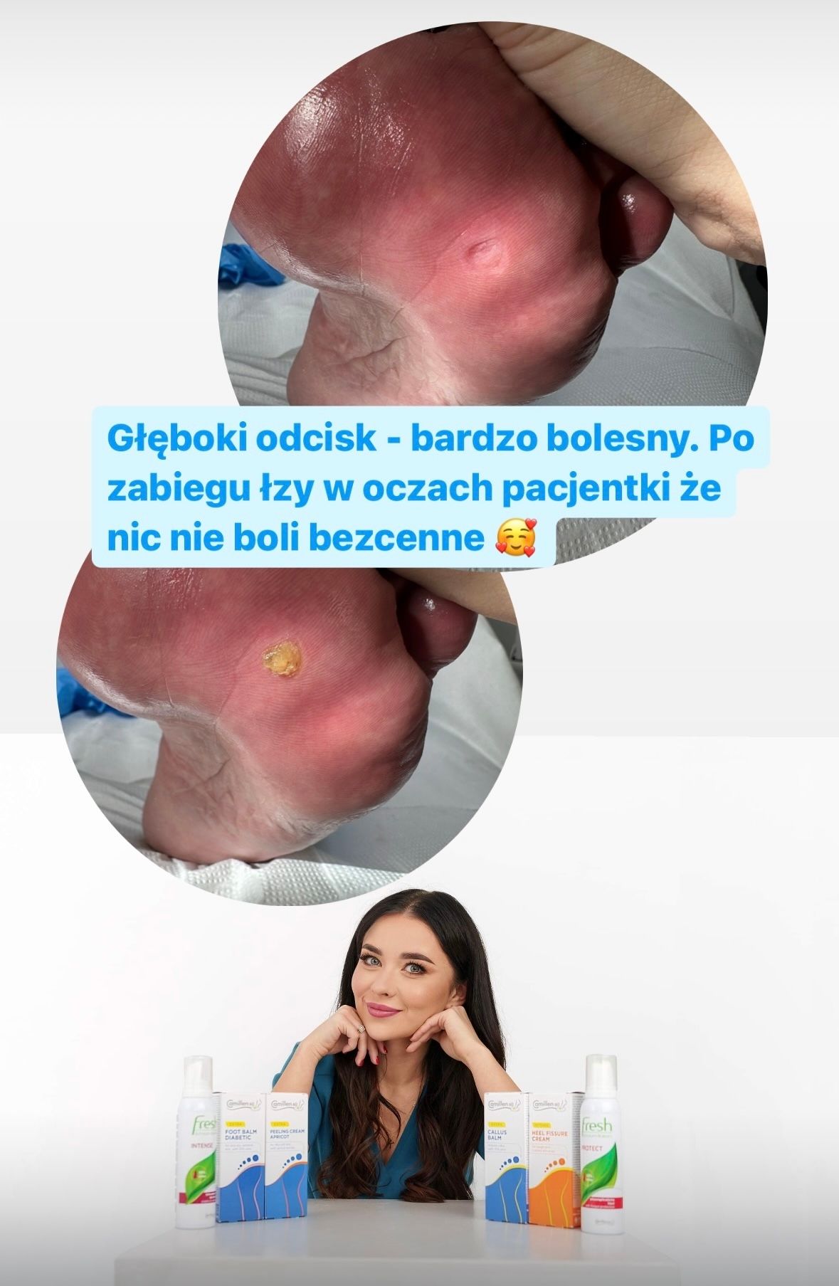 Karolina Colonna-Walewska-25