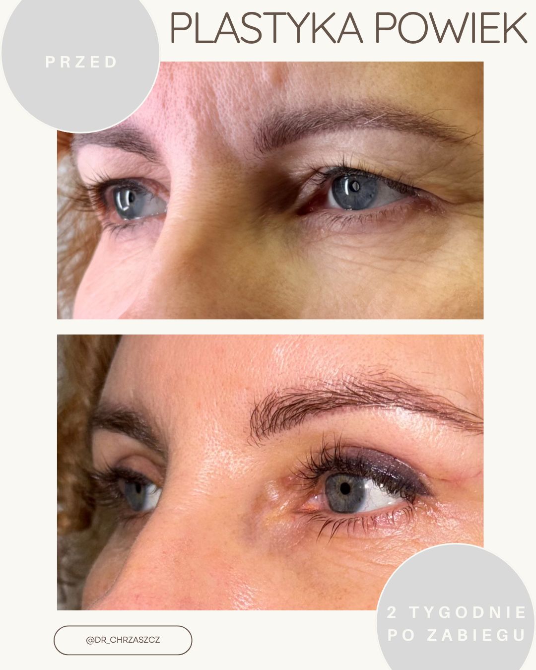 Michał Chrząszcz-10