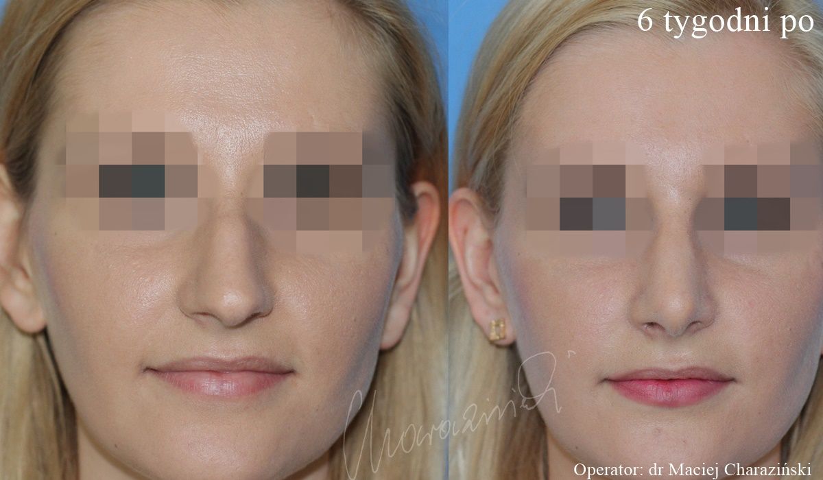 Maciej Charaziński-69