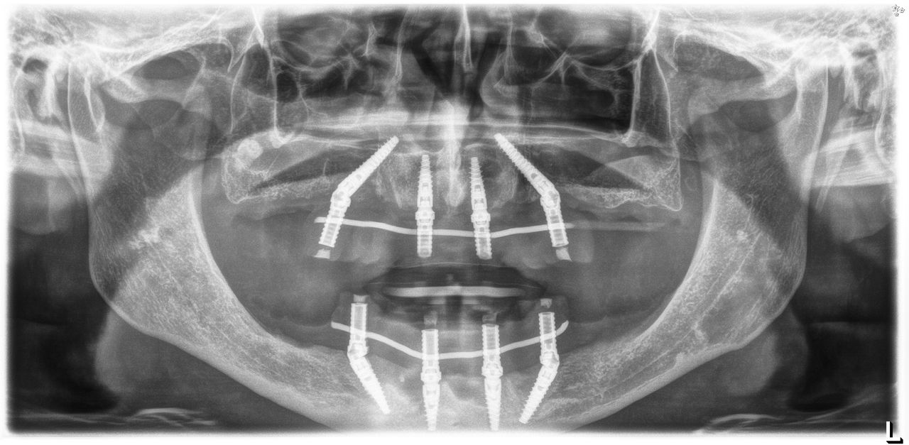 Lorenzo Polpatelli-0