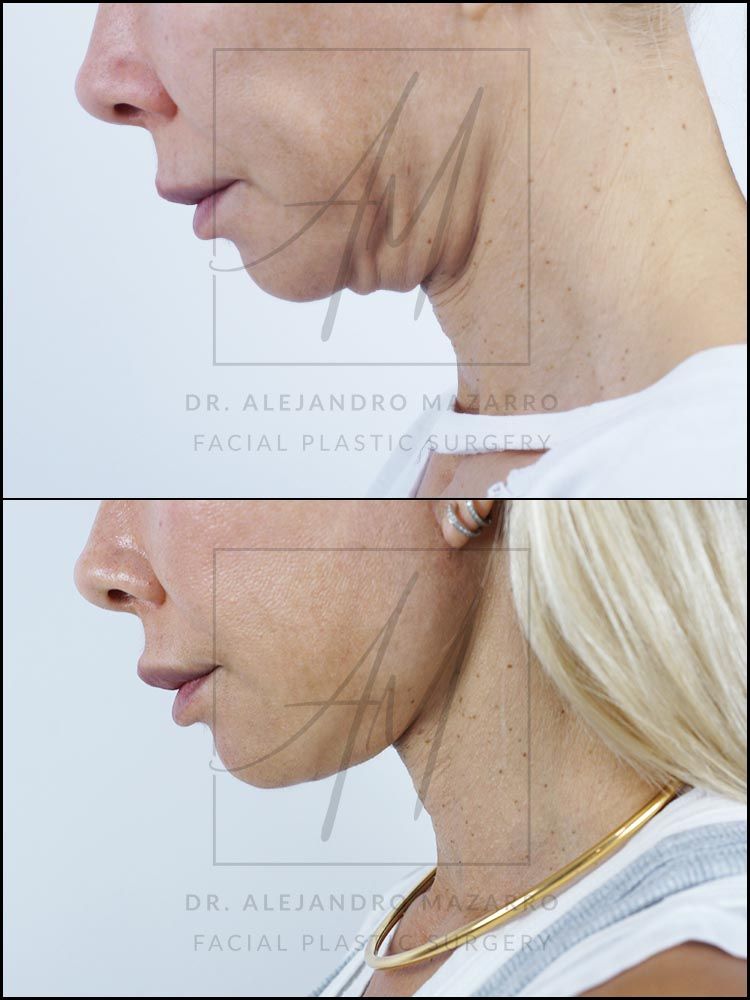 Alejandro Mazarro Campos-10