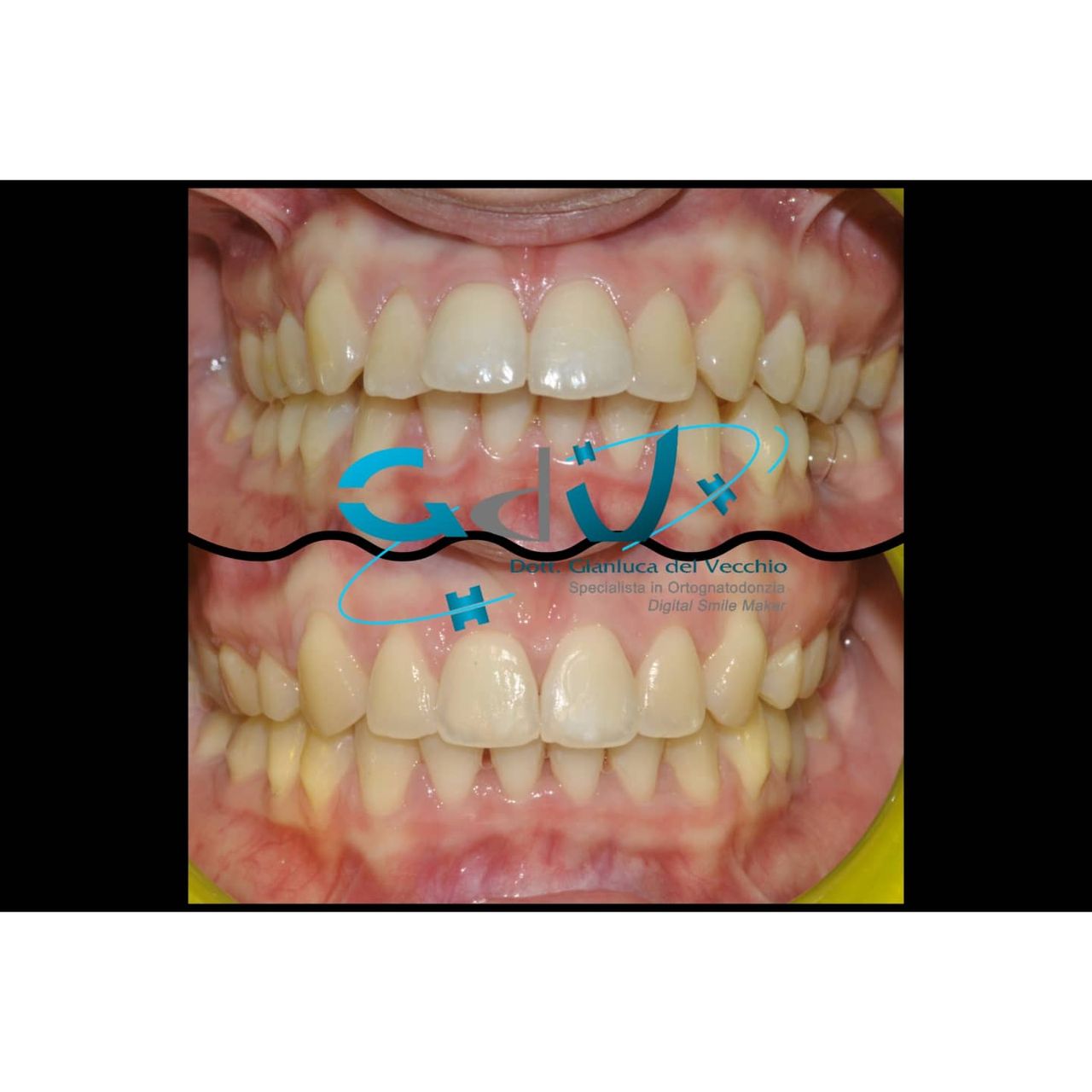 Gianluca Del Vecchio-164