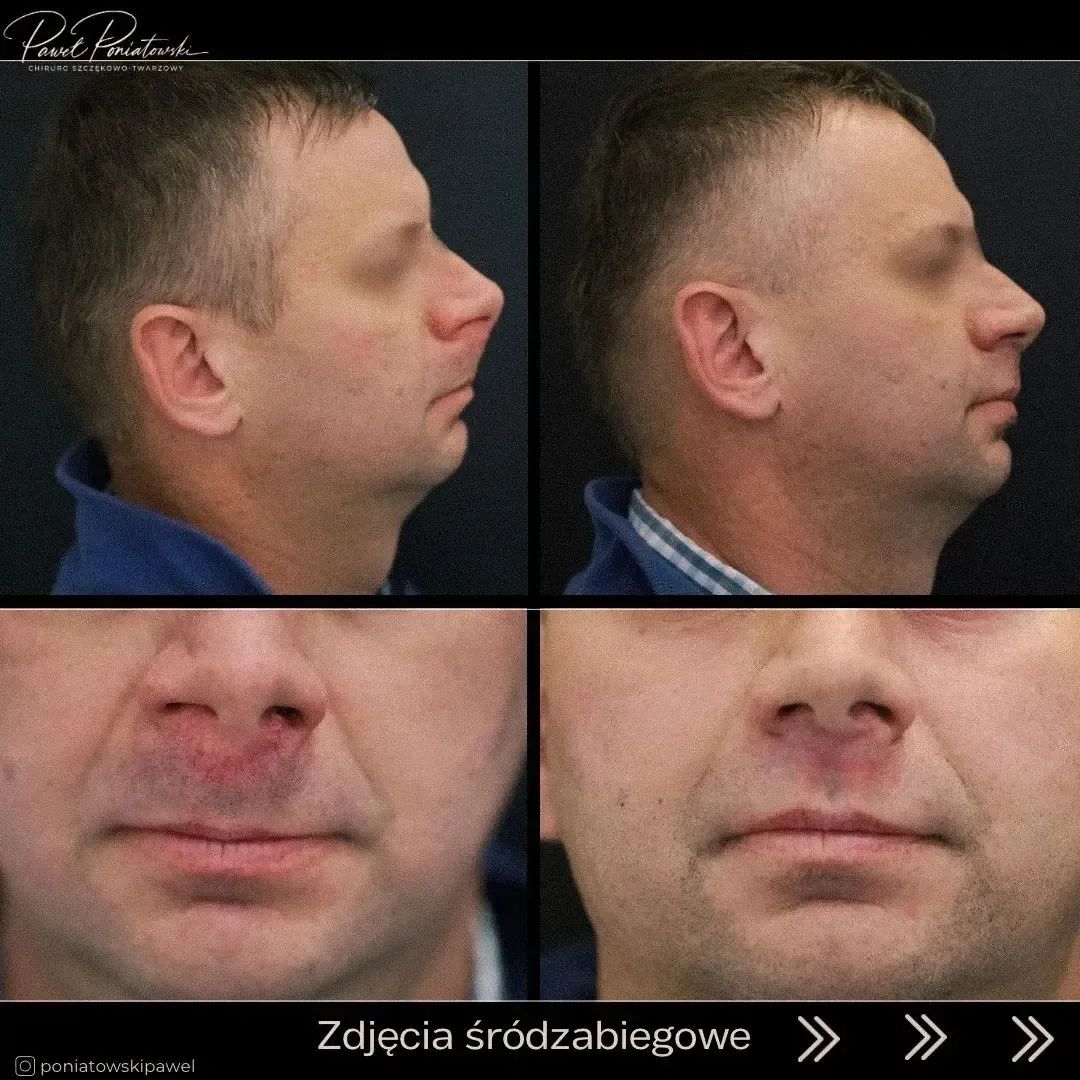 Paweł Poniatowski-11