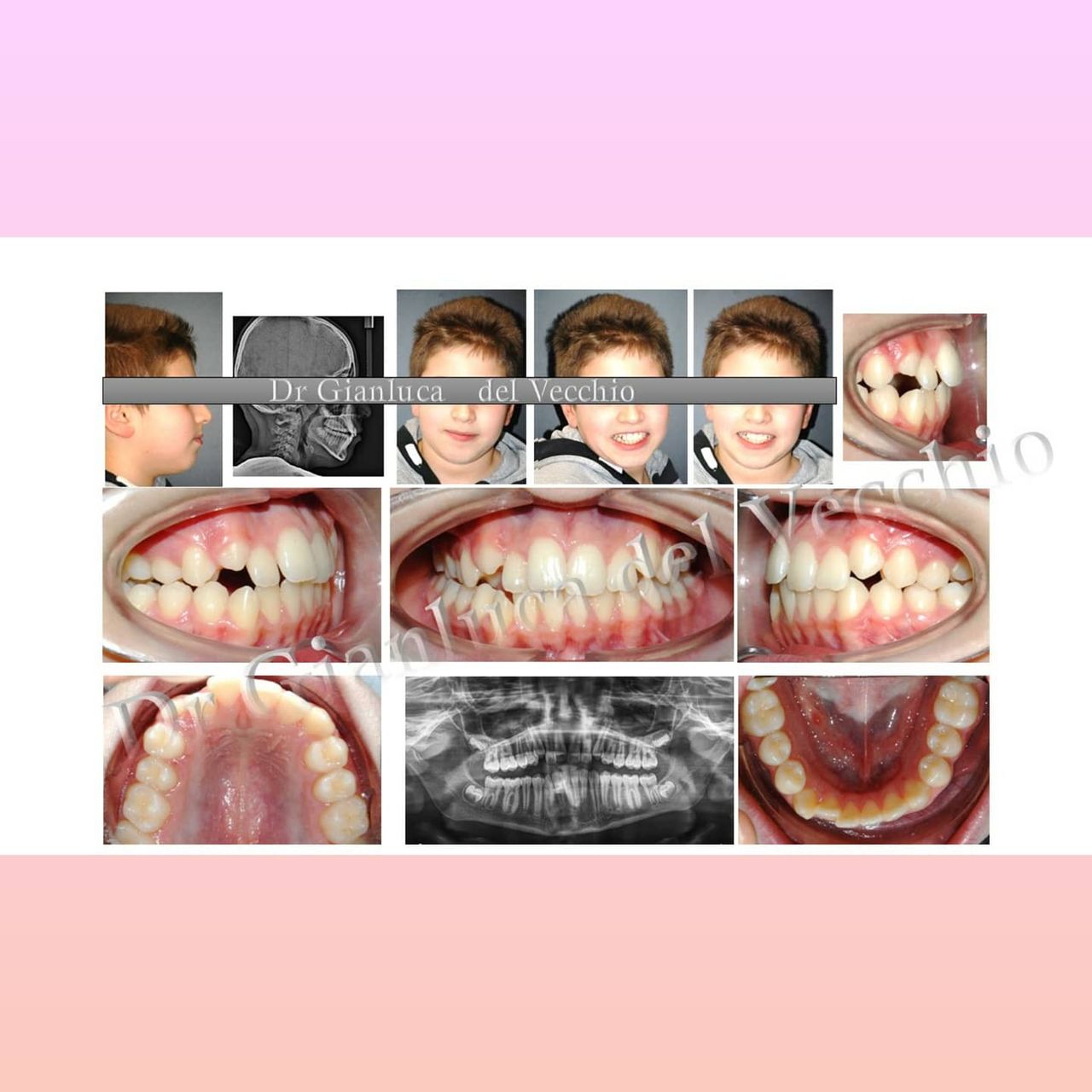 Gianluca Del Vecchio-60