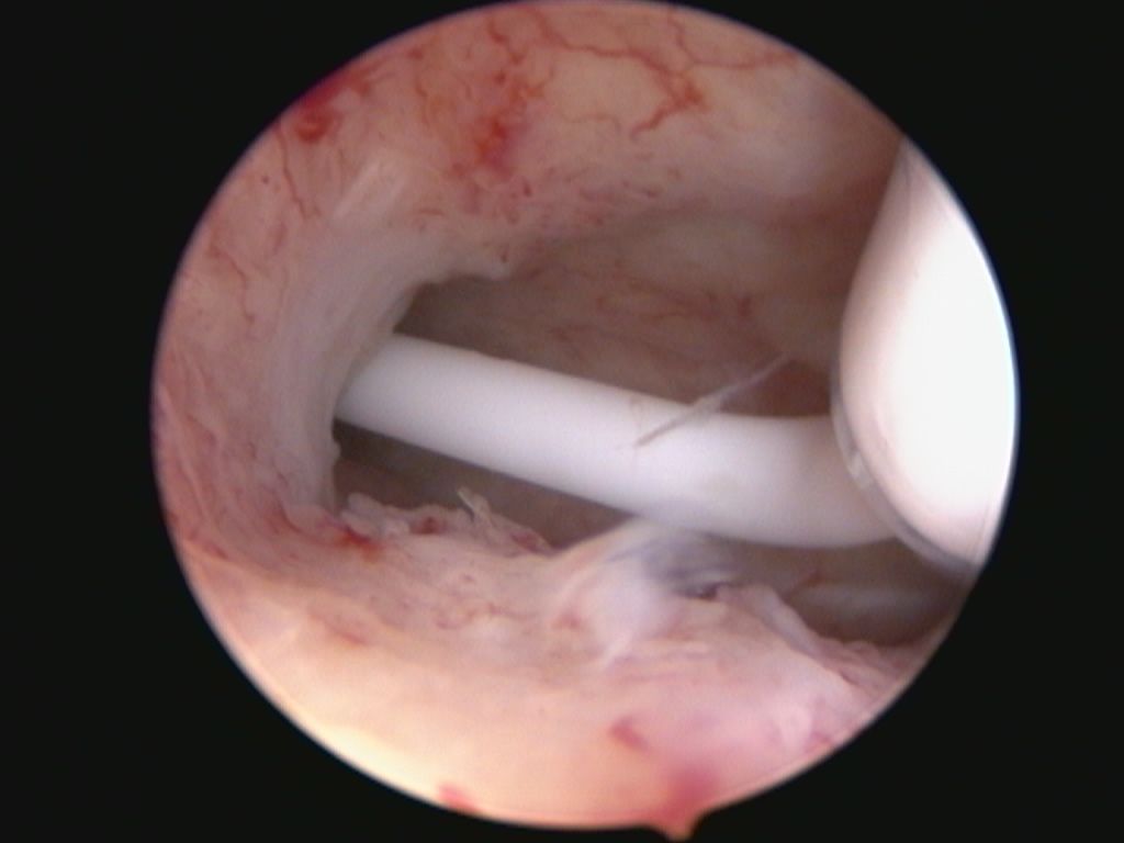 Francesco Paolo Improda-2