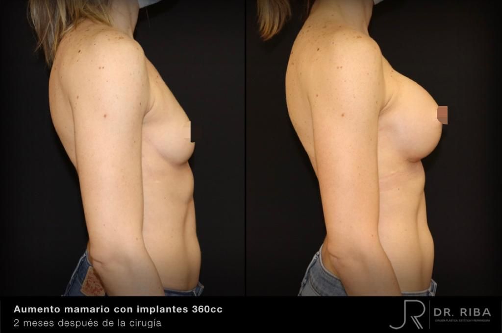 Jordi Riba Vilchez-15