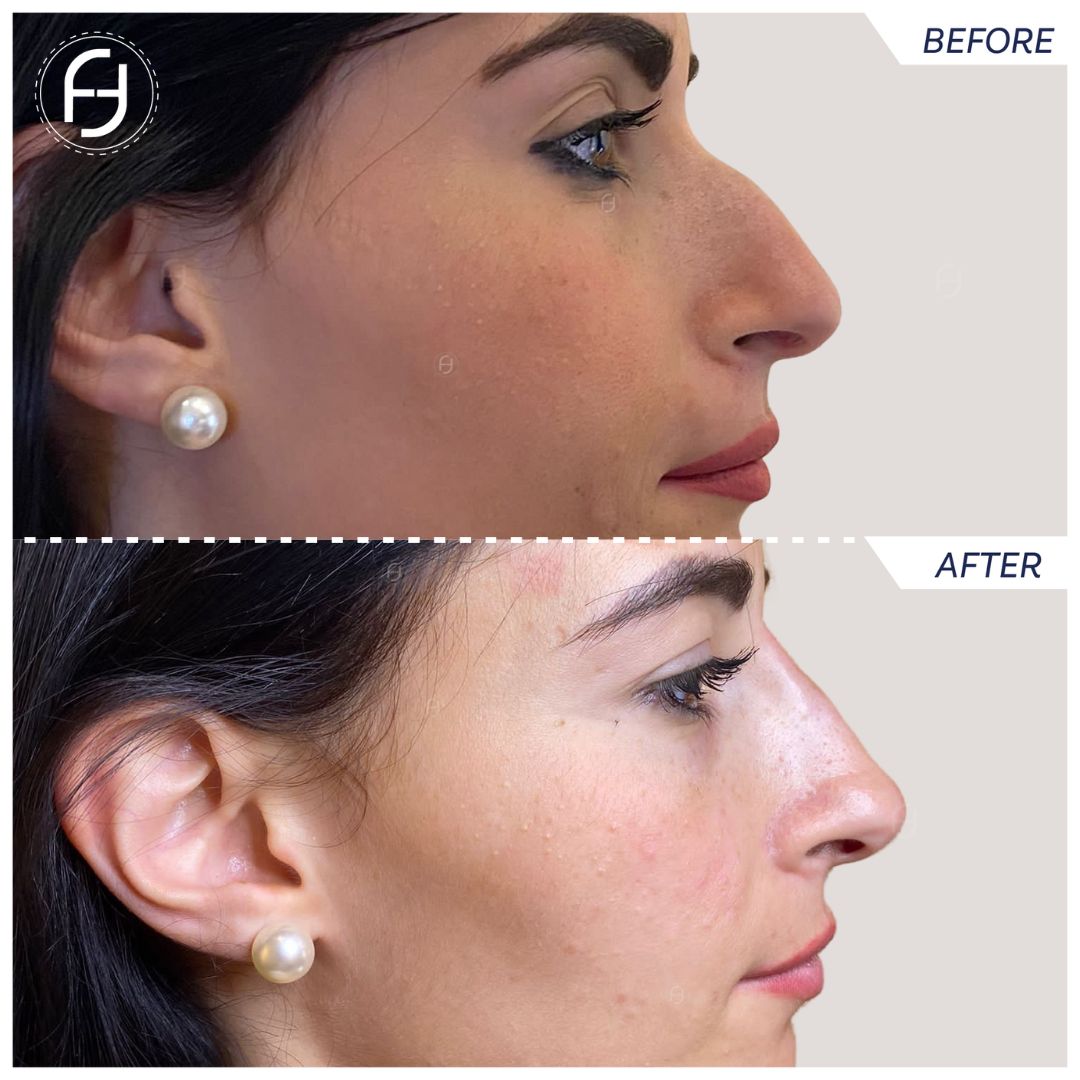 Francesca Flagiello-40