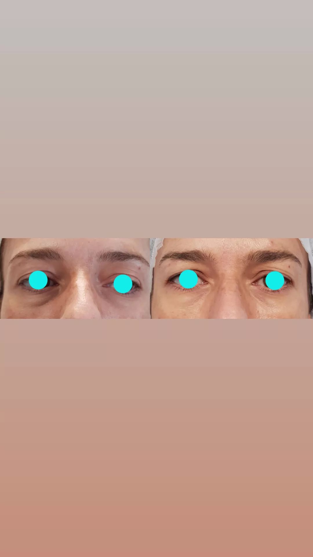 Rosalba Herrero Zerpa-499