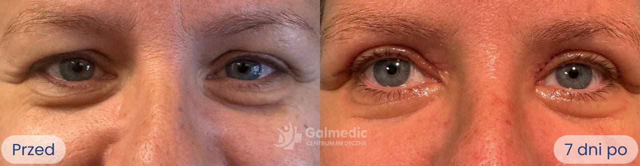 Jakub Staniszewski-1