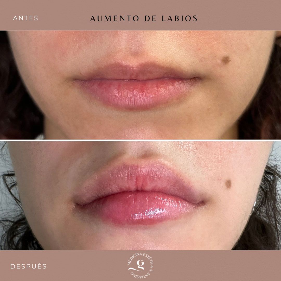 ​Giovanni Giorgianni-21