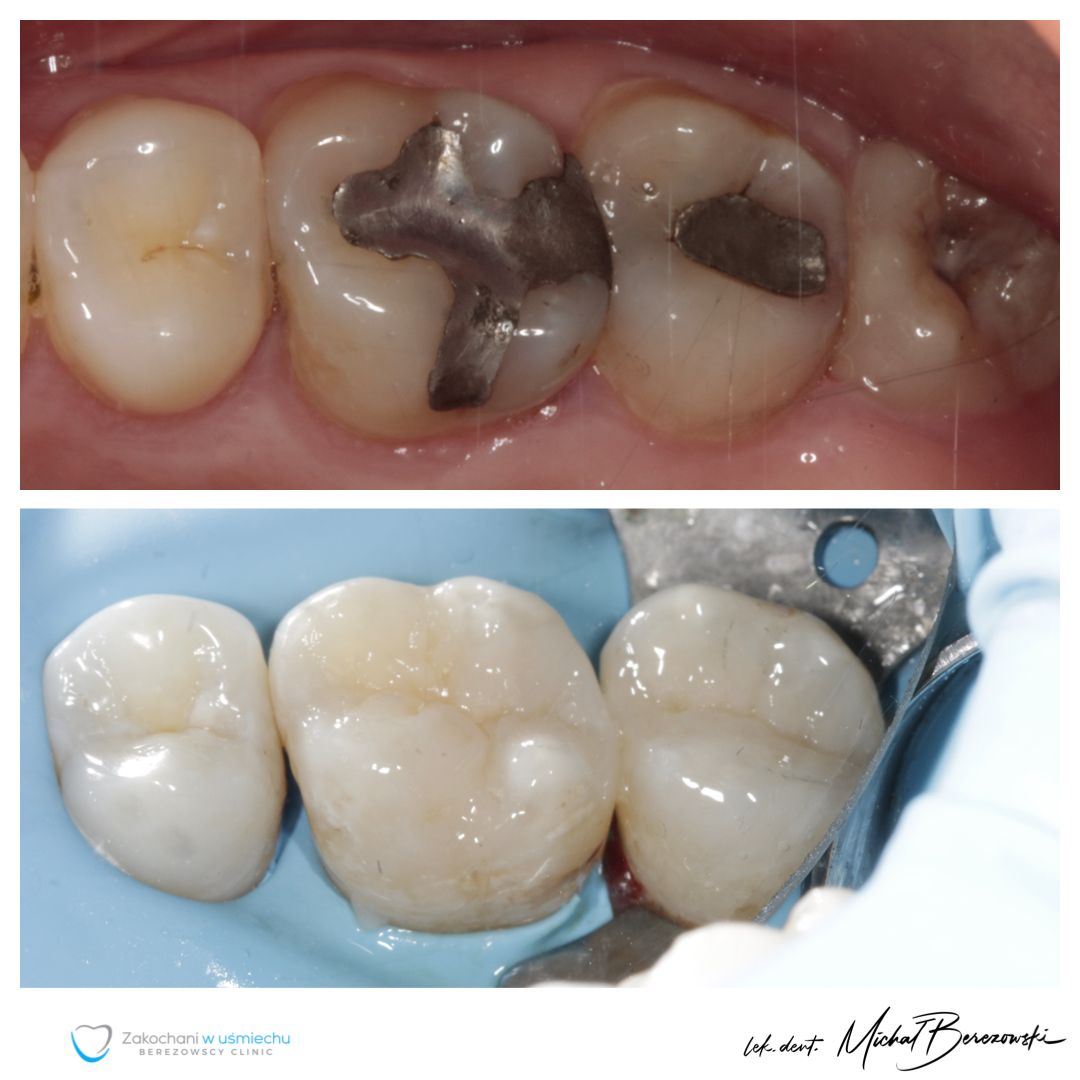 Michał Berezowski-11