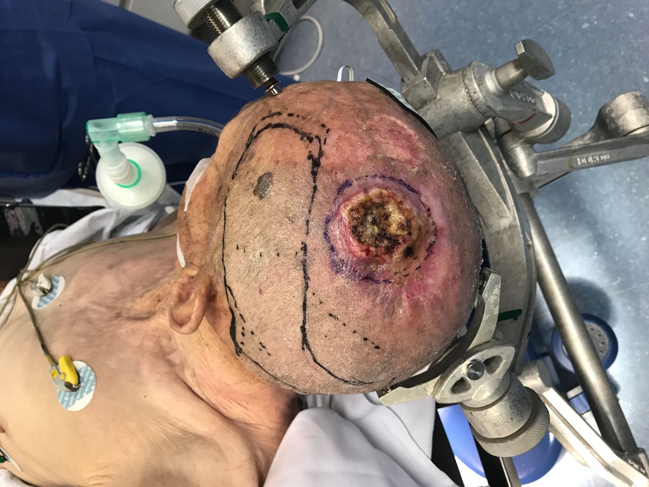 Juan Camilo Hernandez Acevedo-44