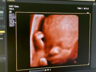 Domenico D'assisi-17