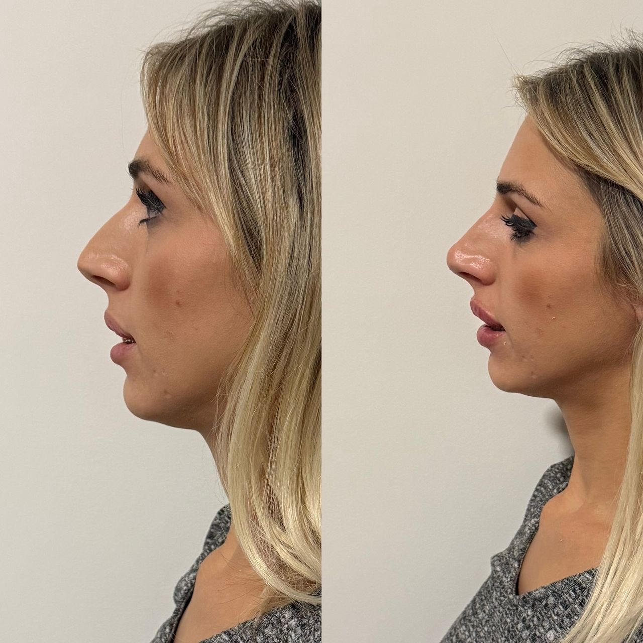 Giovanni D'agosta-11