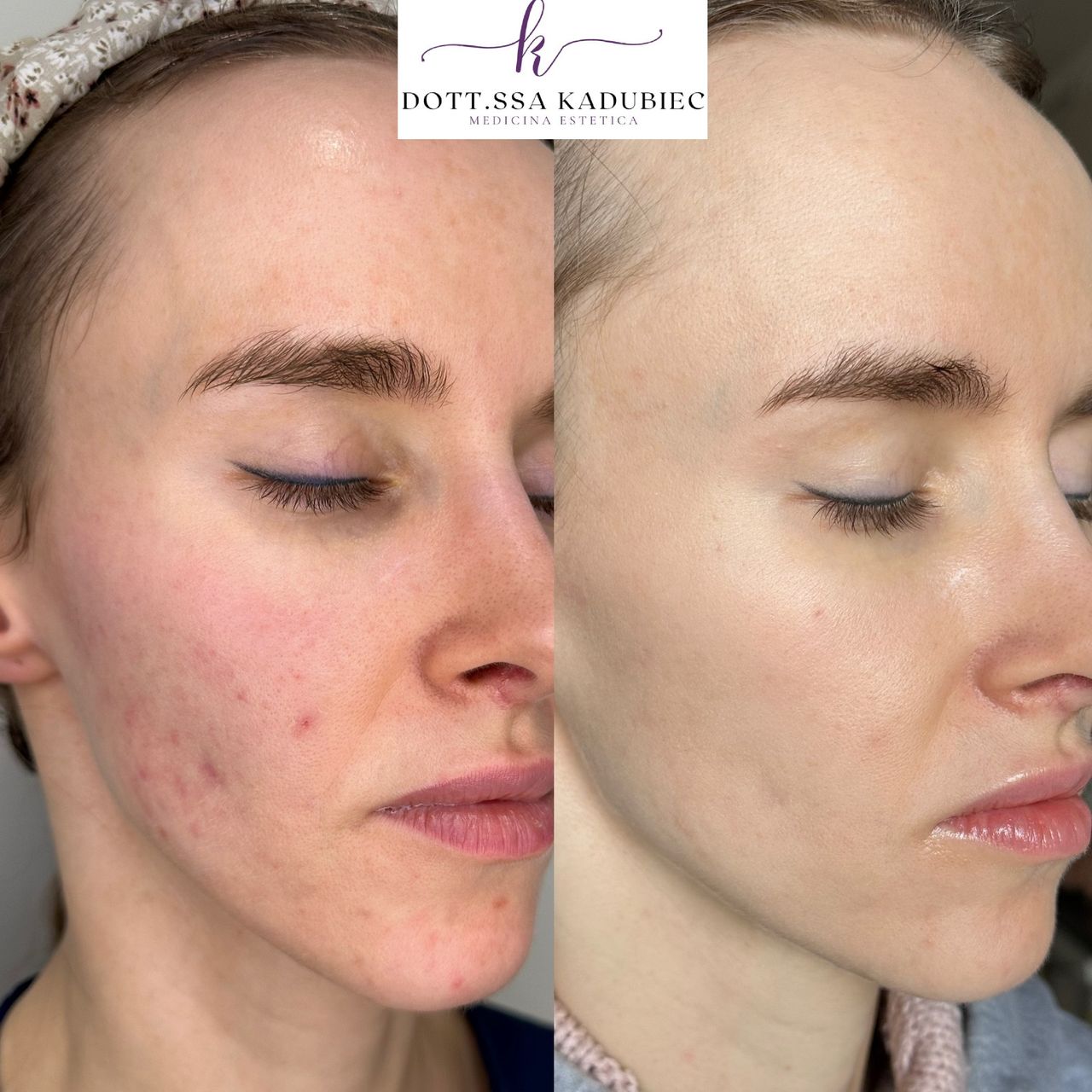 Aleksandra Kadubiec-16