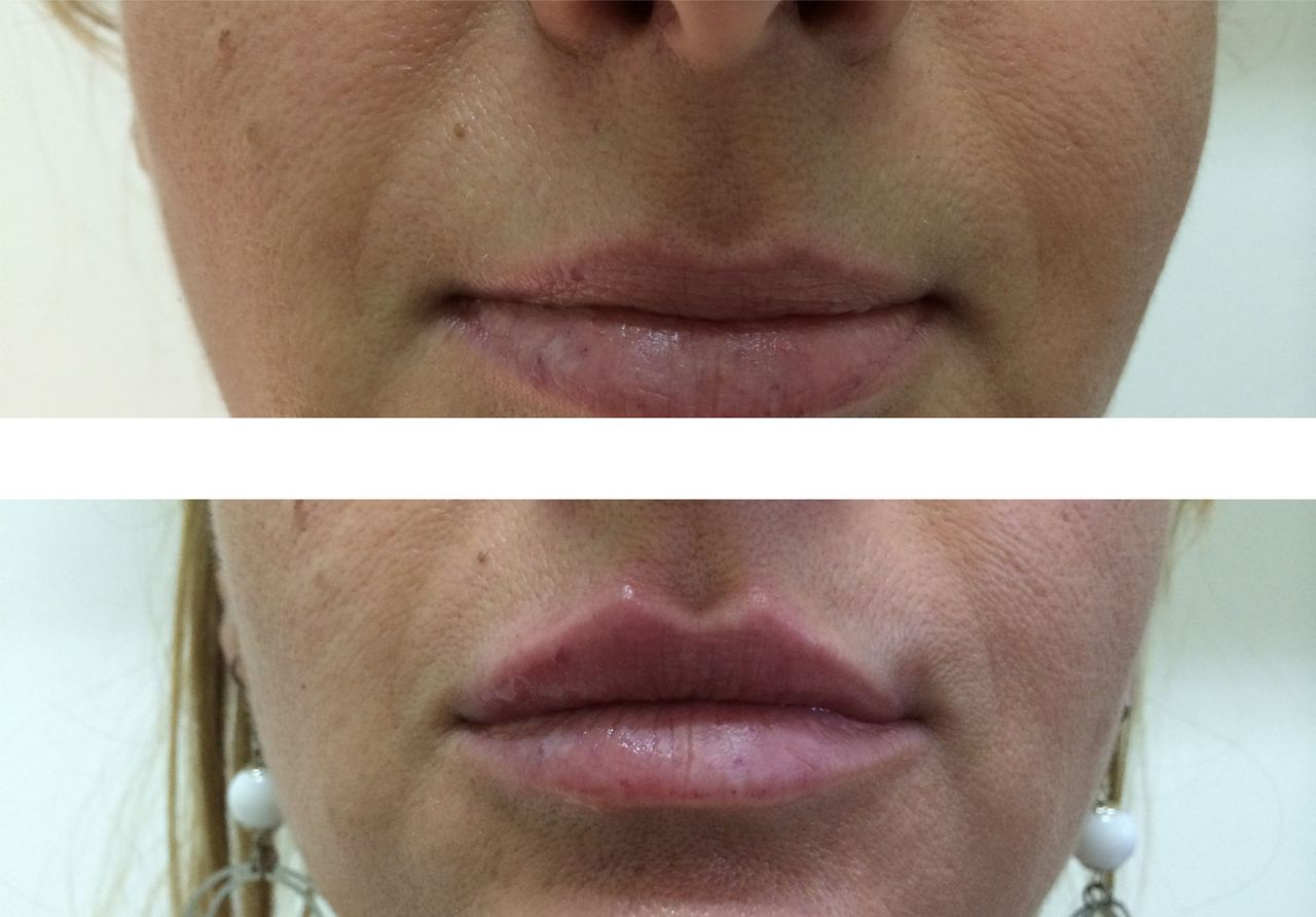 Virginia Cristina Rapisarda-59