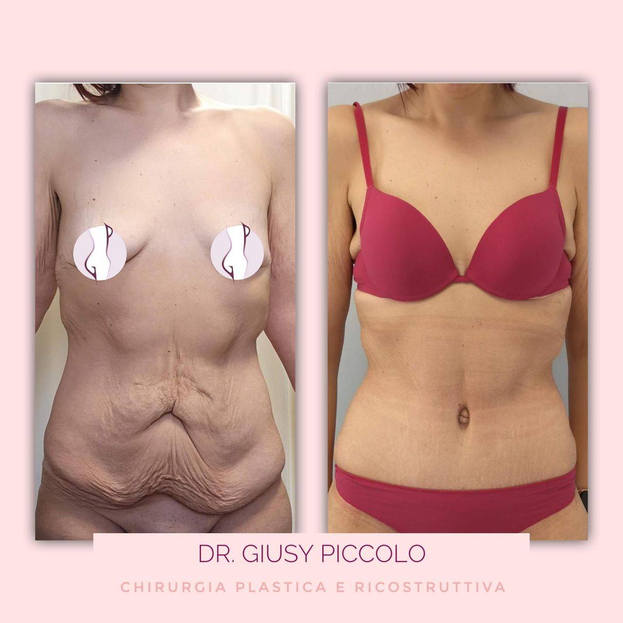 Giuseppina Piccolo-35