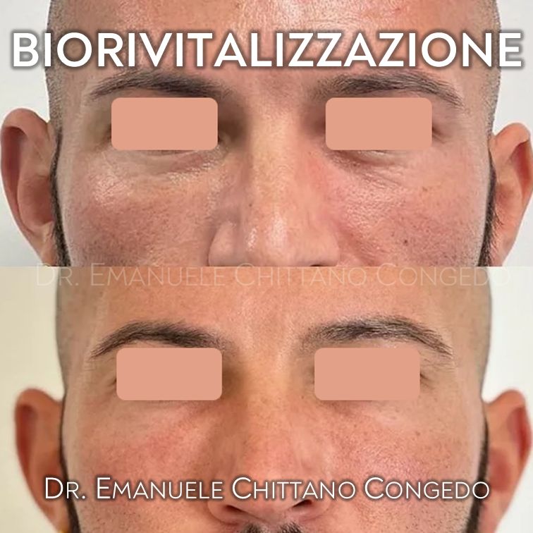 Emanuele Chittano Congedo-10