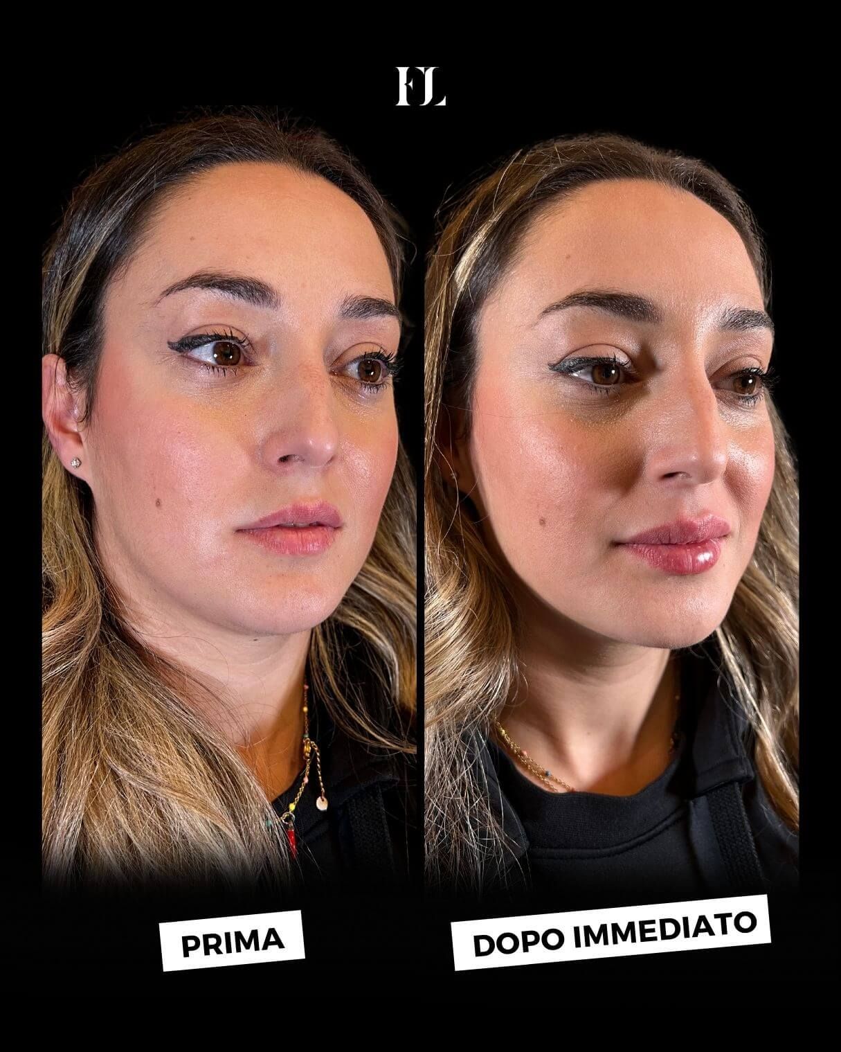 Floriana Lauritano-38