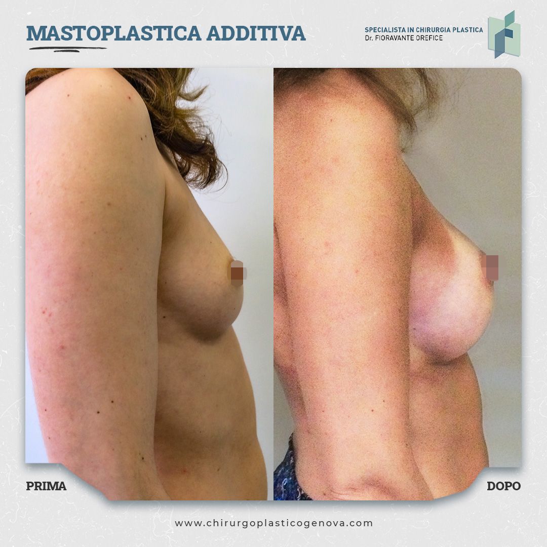 Fioravante Orefice-10