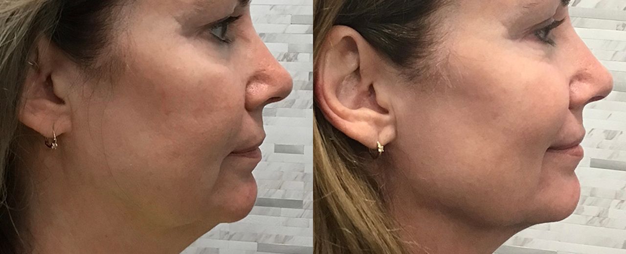 Noemi Virginia Cretu-19