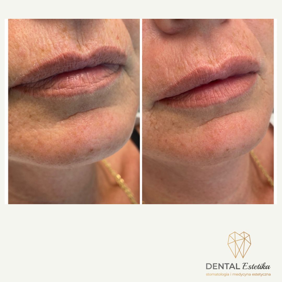 Angelika Świątkowska-28