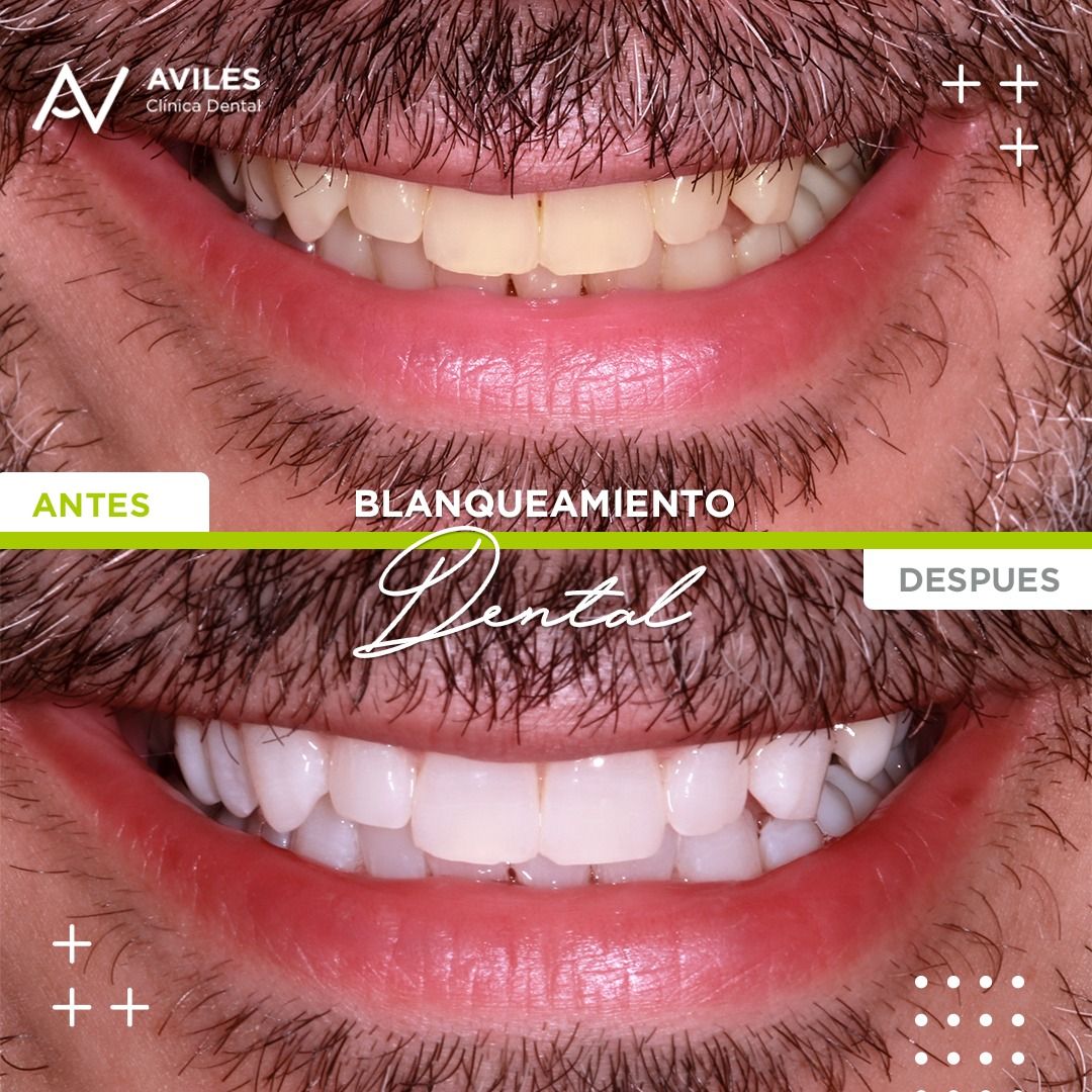 Antonia Aviles Lopez-46