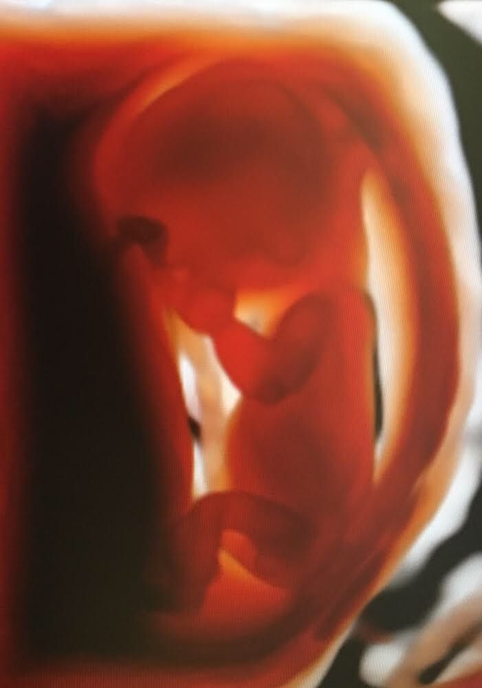 Andrzej Kałamacki-12