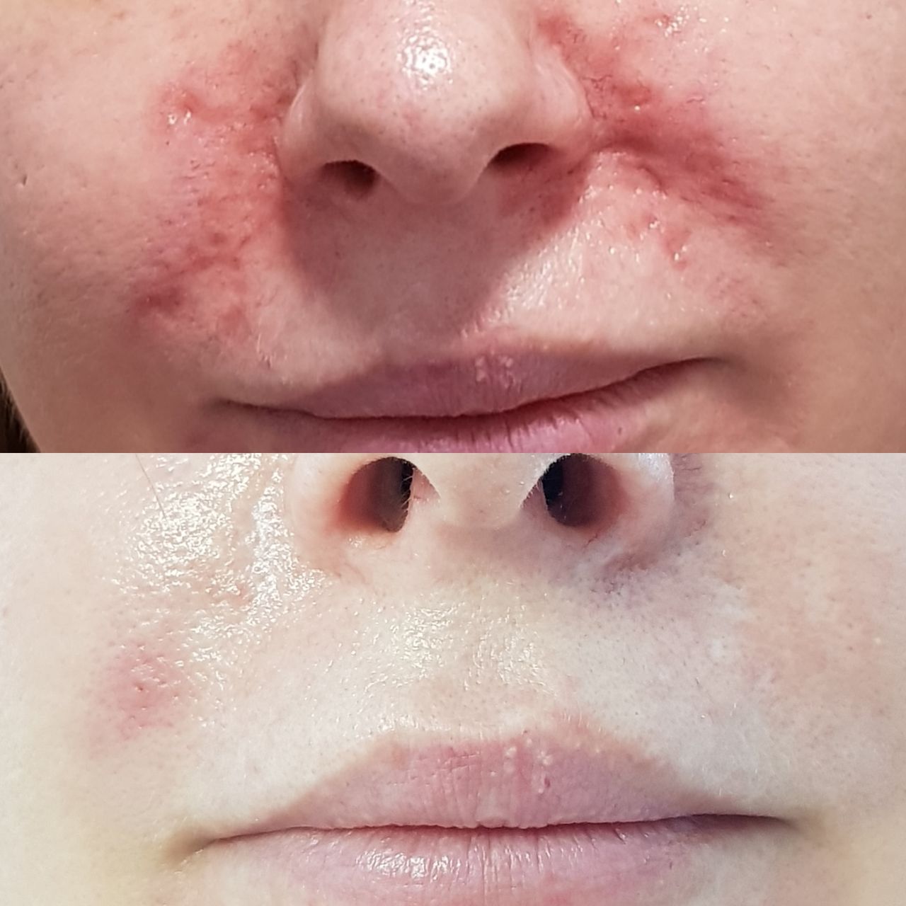 Rosalba Herrero Zerpa-248