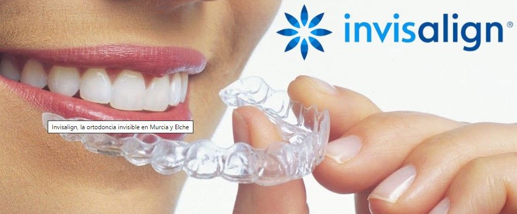 Ernesto Ruiz Chumilla-6